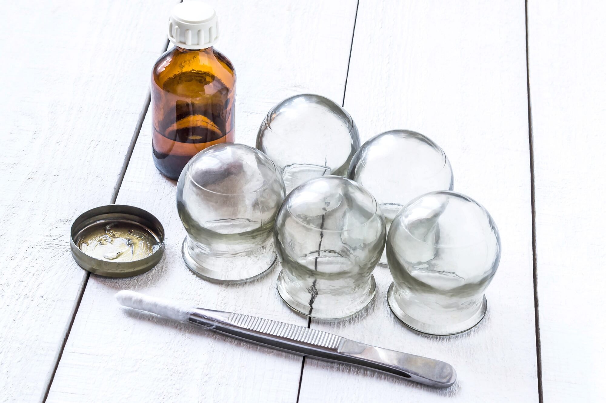 What is Cupping Therapy and How Does It Work?
