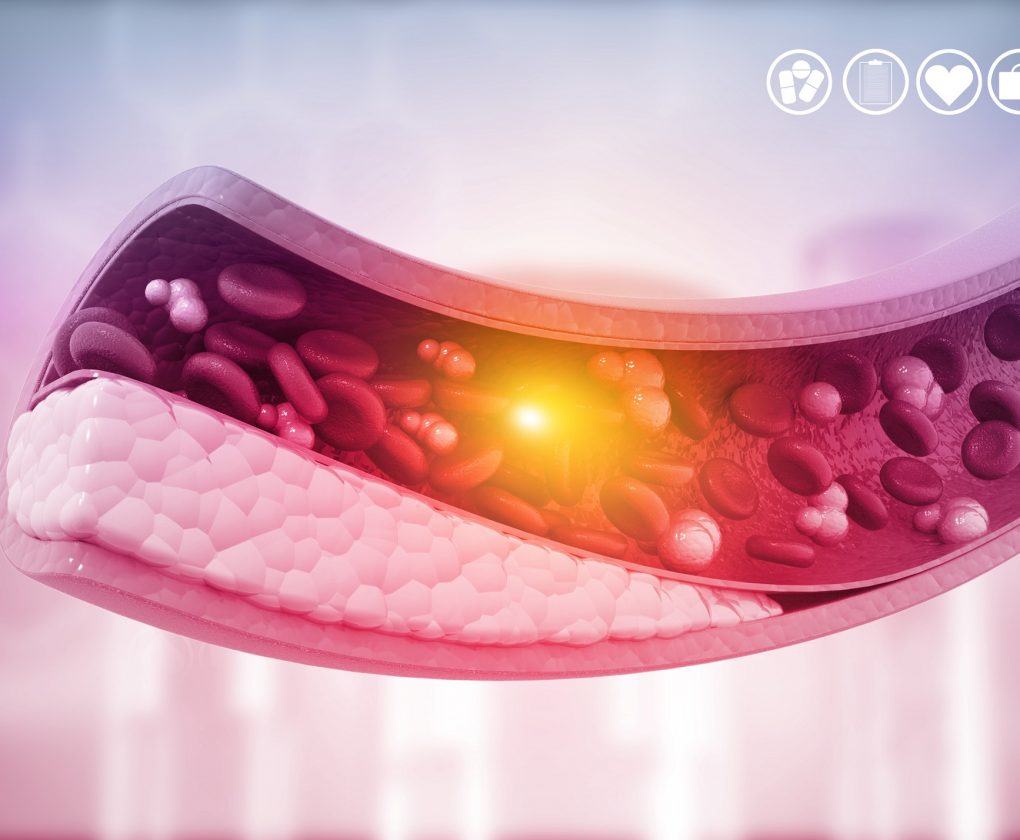 Cognitive function and atherosclerosis