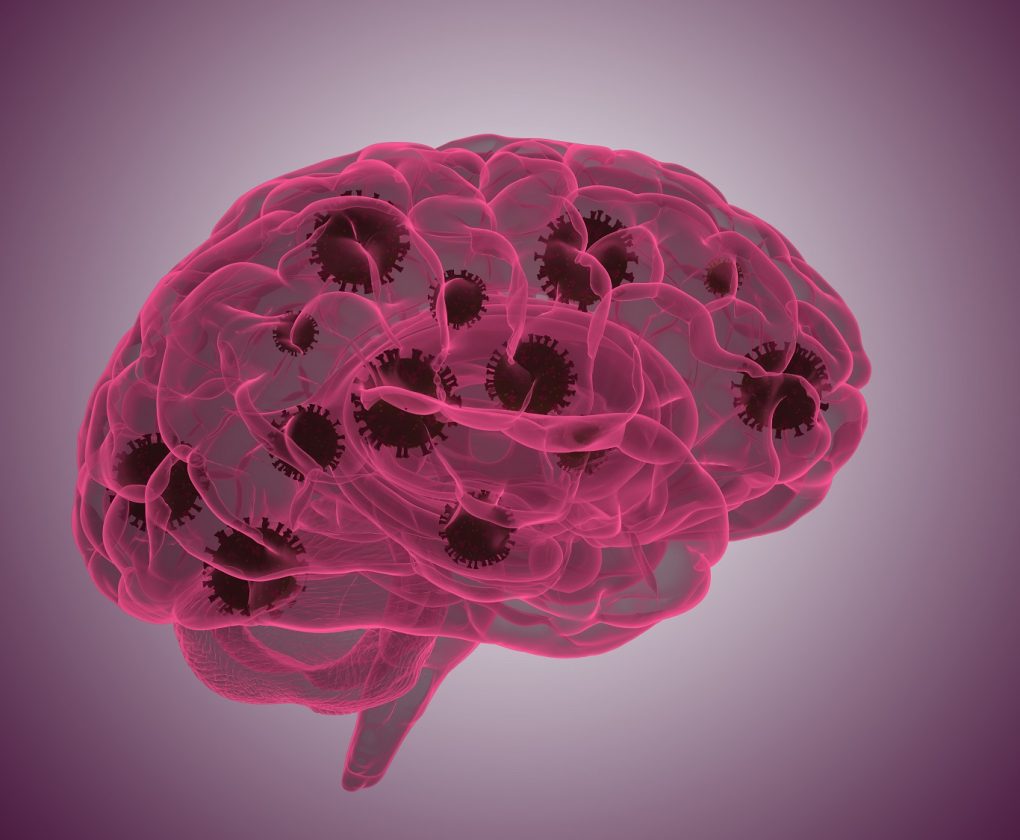 Covid and brain health